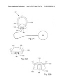 METHOD FOR THE TREATMENT OF GALLSTONES diagram and image