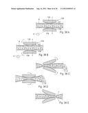 METHOD FOR THE TREATMENT OF GALLSTONES diagram and image