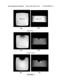 IMPLANTABLE MEDICAL DEVICE diagram and image