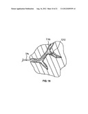 LOW-PROFILE INTRALUMINAL LIGHT DELIVERY SYSTEM AND METHODS OF USING THE     SAME diagram and image