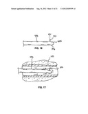 LOW-PROFILE INTRALUMINAL LIGHT DELIVERY SYSTEM AND METHODS OF USING THE     SAME diagram and image