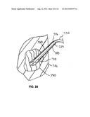 LOW-PROFILE INTRALUMINAL LIGHT DELIVERY SYSTEM AND METHODS OF USING THE     SAME diagram and image