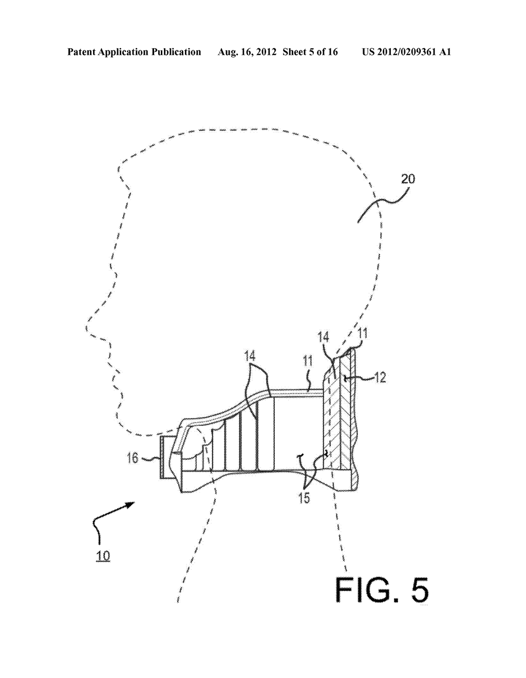 Cold Therapy Apparatuses, Systems and/or Methods - diagram, schematic, and image 06