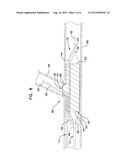 BIFURCATION CATHETER DUAL BALLOON BOND AND METHODS diagram and image