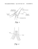 FENESTRATED ENDOGRAFT diagram and image
