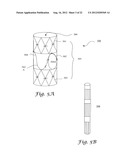 FENESTRATED ENDOGRAFT diagram and image