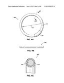 ADJUSTABLE ANNULOPLASTY RING AND ACTIVATION SYSTEM diagram and image