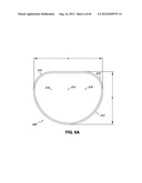 ADJUSTABLE ANNULOPLASTY RING AND ACTIVATION SYSTEM diagram and image