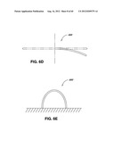 ADJUSTABLE ANNULOPLASTY RING AND ACTIVATION SYSTEM diagram and image