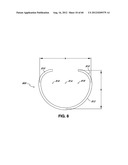 ADJUSTABLE ANNULOPLASTY RING AND ACTIVATION SYSTEM diagram and image