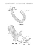 ADJUSTABLE ANNULOPLASTY RING AND ACTIVATION SYSTEM diagram and image