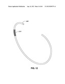 ADJUSTABLE ANNULOPLASTY RING AND ACTIVATION SYSTEM diagram and image