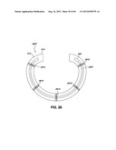 ADJUSTABLE ANNULOPLASTY RING AND ACTIVATION SYSTEM diagram and image