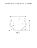 ADJUSTABLE ANNULOPLASTY RING AND ACTIVATION SYSTEM diagram and image