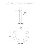 ADJUSTABLE ANNULOPLASTY RING AND ACTIVATION SYSTEM diagram and image