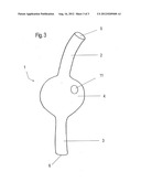 Medical Implant diagram and image