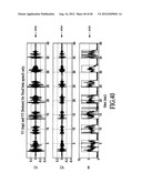 Dynamic enhancement of audio (DAE) in headset systems diagram and image