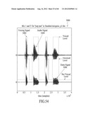 Dynamic enhancement of audio (DAE) in headset systems diagram and image