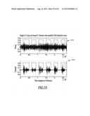 ACOUSTIC VOICE ACTIVITY DETECTION diagram and image