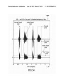 ACOUSTIC VOICE ACTIVITY DETECTION diagram and image