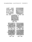 IMMUNONEUTRAL SILK-FIBER-BASED MEDICAL DEVICES diagram and image