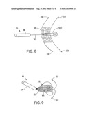 INTERCEPTOR PROJECTILE AND METHOD OF USE diagram and image