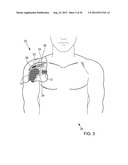 METHODS AND APPARATUS FOR FIXING SHEET-LIKE MATERIALS TO A TARGET TISSUE diagram and image