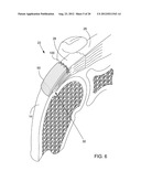 METHODS AND APPARATUS FOR FIXING SHEET-LIKE MATERIALS TO A TARGET TISSUE diagram and image