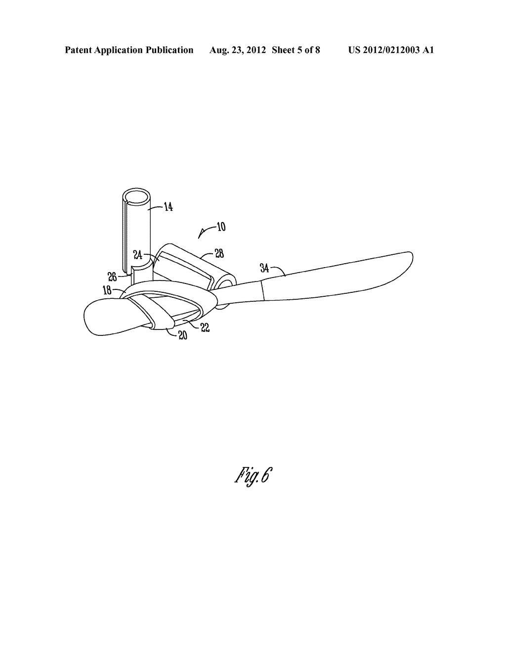 TERMINAL END MOUNTED PROSTHETIC DEVICE - diagram, schematic, and image 06