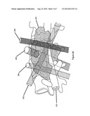 ADAPTIVE X-RAY CONTROL diagram and image