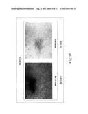 Prodrug composition for skin with twin protecting groups bound by     disubstituted benzene diagram and image