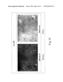 Prodrug composition for skin with twin protecting groups bound by     disubstituted benzene diagram and image