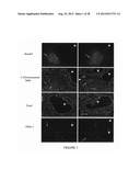 METHODS AND COMPOSITIONS FOR TREATING AUTOIMMUNE DISEASES diagram and image