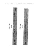 EMBOSSING SYSTEM AND PRODUCT MADE THEREBY WITH BOTH PERFORATE BOSSES IN     THE CROSS MACHINE DIRECTION AND A MACRO PATTERN diagram and image