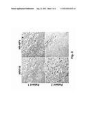 RNASCOPE.RTM. HPV ASSAY FOR DETERMINING HPV STATUS IN HEAD AND NECK     CANCERS AND CERVICAL LESIONS diagram and image