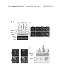 GENE AND POLYPEPTIDE RELATING TO BREAST CANCER diagram and image