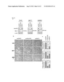 GENE AND POLYPEPTIDE RELATING TO BREAST CANCER diagram and image