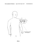 TRANSFECTION WITH MAGNETIC NANOPARTICLES AND ULTRASOUND diagram and image