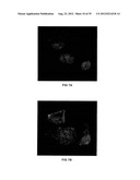 TRANSFECTION WITH MAGNETIC NANOPARTICLES AND ULTRASOUND diagram and image