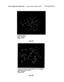 TRANSFECTION WITH MAGNETIC NANOPARTICLES AND ULTRASOUND diagram and image