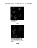 TRANSFECTION WITH MAGNETIC NANOPARTICLES AND ULTRASOUND diagram and image