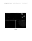 TRANSFECTION WITH MAGNETIC NANOPARTICLES AND ULTRASOUND diagram and image