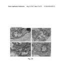 TRANSFECTION WITH MAGNETIC NANOPARTICLES AND ULTRASOUND diagram and image