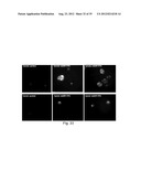 TRANSFECTION WITH MAGNETIC NANOPARTICLES AND ULTRASOUND diagram and image