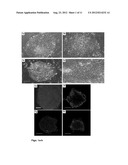 METHODS OF CULTURING CELLS IN A MEDIUM COMPRISING TRANSFORMING GROWTH     FACTOR BETA 1 AND BASIC FIBROBLAST GROWTH FACTOR diagram and image