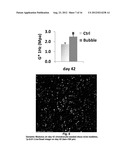 MICROBUBBLE DEVICES, METHODS AND SYSTEMS diagram and image