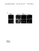 COMPOSITIONS AND METHODS FOR DETECTING AND TREATING PROSTATE CARCINOMA diagram and image