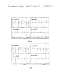 PRODUCT, METHOD AND SYSTEM FOR MONITORING PHYSIOLOGICAL FUNCTION AND     POSTURE diagram and image