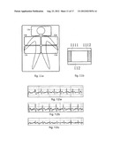 PRODUCT, METHOD AND SYSTEM FOR MONITORING PHYSIOLOGICAL FUNCTION AND     POSTURE diagram and image