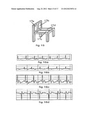 PRODUCT, METHOD AND SYSTEM FOR MONITORING PHYSIOLOGICAL FUNCTION AND     POSTURE diagram and image